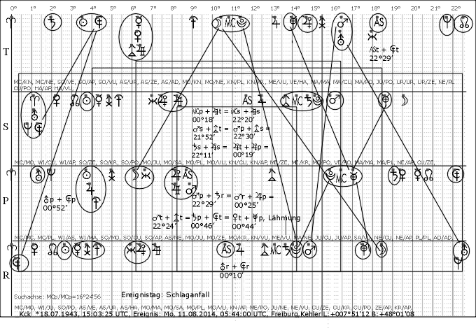 kck_Schlaganfall_2014_0811_MCp.gif