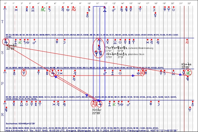Abb.4,Kroencke,K,F.,Bluterguss_SOtSAs_2024_1126_22.jpg